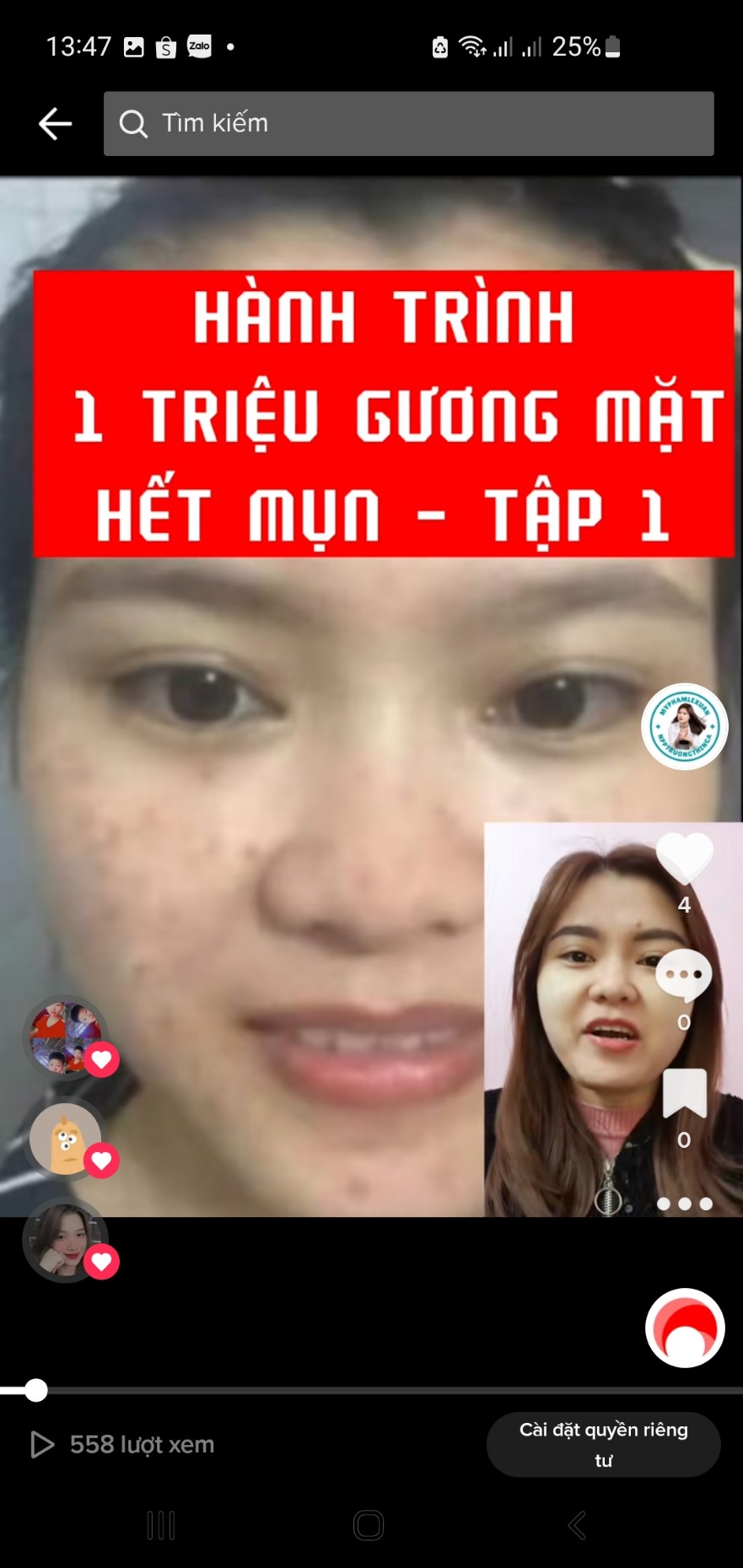 Review trị mụn Lê Xuân 01